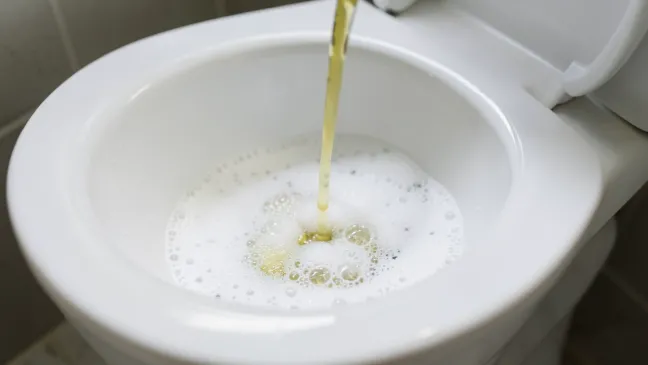 Czyszczenie Toalety Soda I Octem