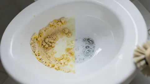 jak pozbyć się kamienia z toalety