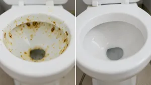 Jak Usunąć Kamień Z Toalety